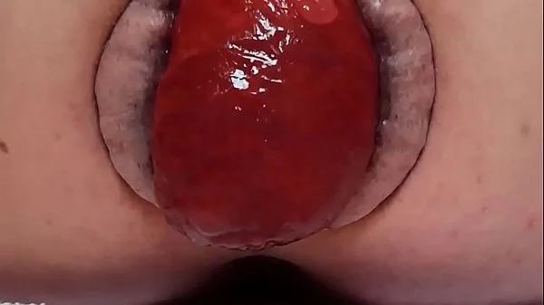 Contender For Biggest Prolapse (Male Warning!)
