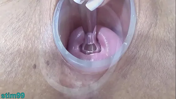 Japanese Wife Open Cervix Wide to watch inside Uterus